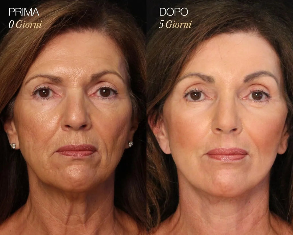 Lymphatic Contour Face Brush