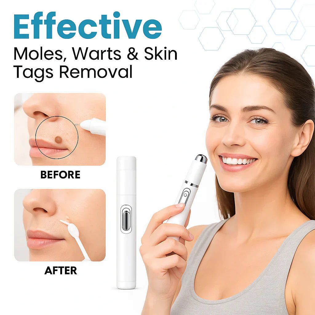 Blue laser pen for stain removal