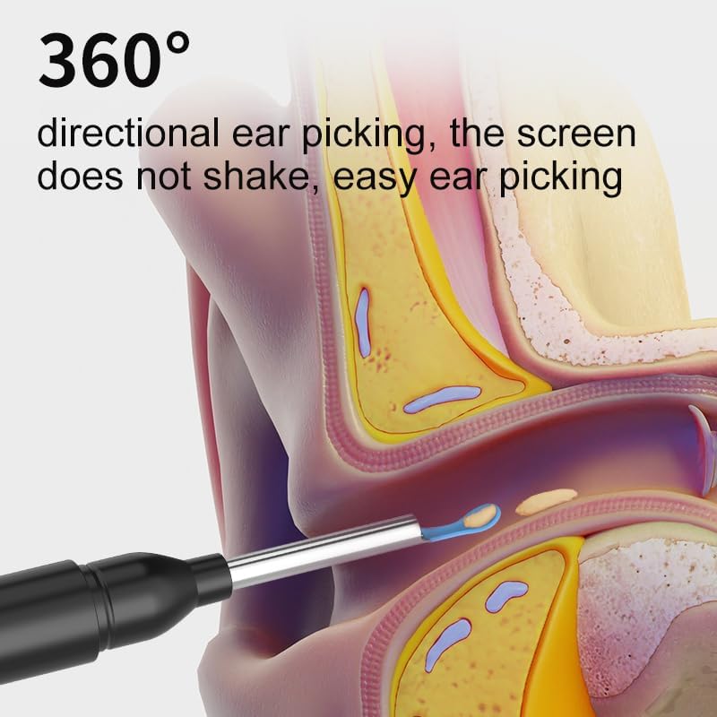 Smart visual ear pick