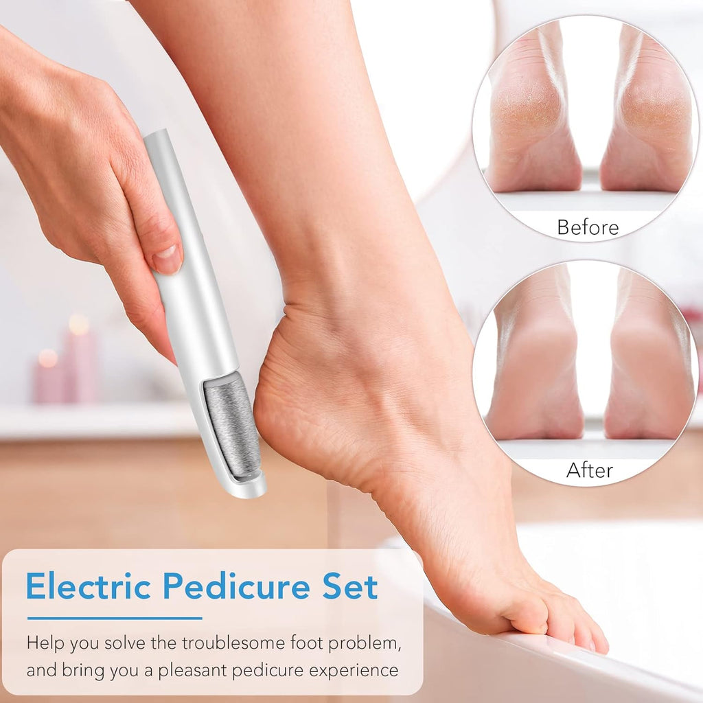 Rechargeable Electric Foot File – Smooth Heels, Anytime Anywhere