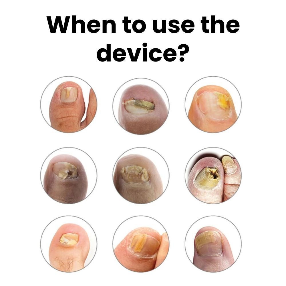 OrthoVital Device
