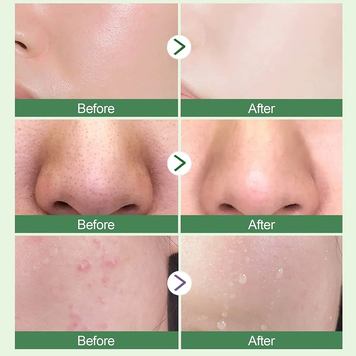 Green Tea Mask Stick Blackhead Remover