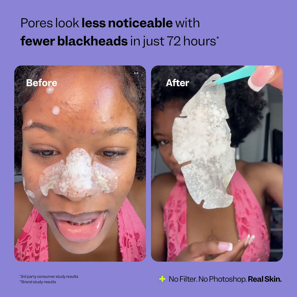 NOSE PATCHES