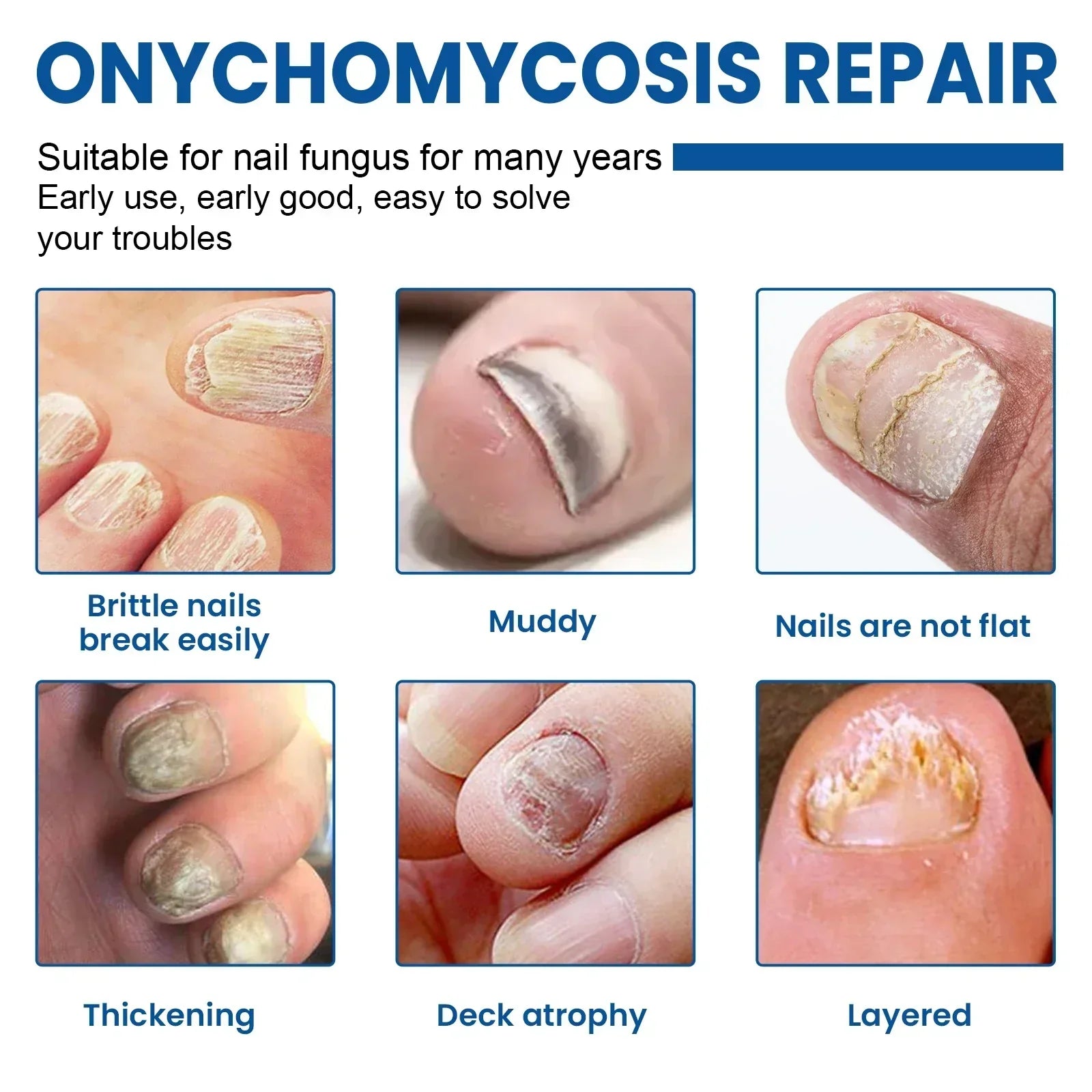 Fungus Nail Repair Patches 60pcs