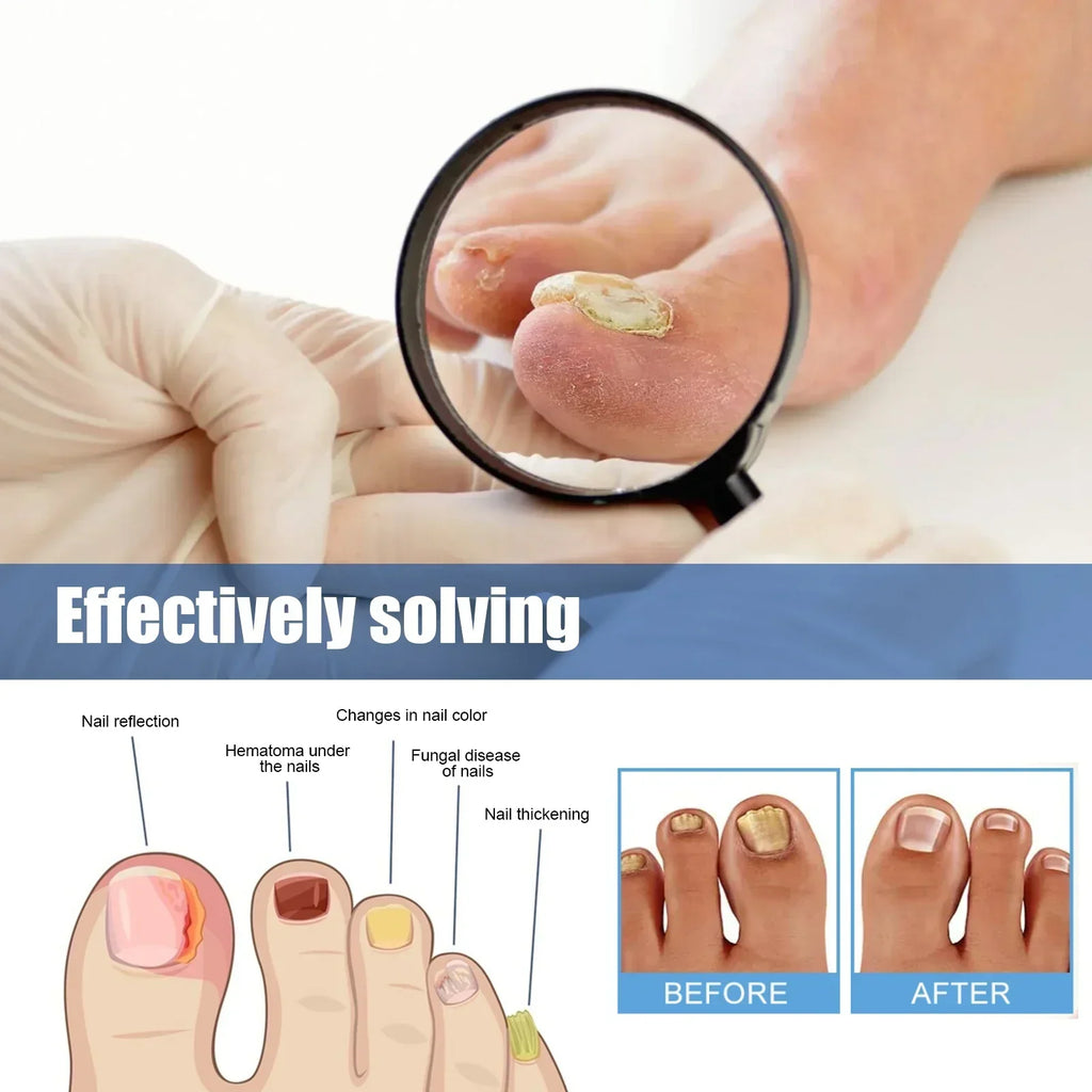 Fungus Nail Repair Patches 60pcs