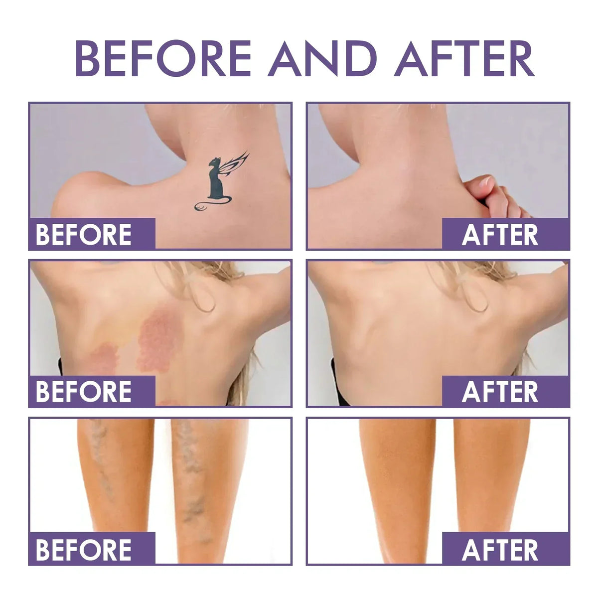 Body Perfector