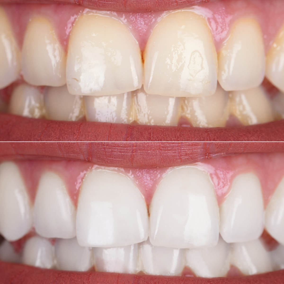 Purple Toothpaste