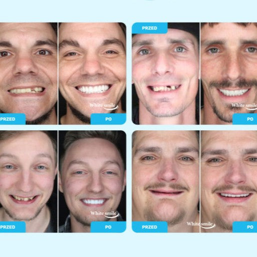ADAPTABLE TEETH SET FOR A PERFECT SMILE